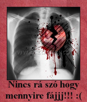 Nincs rá szó hogy mennyire fájjj!!! :( Nincs rá szó hogy mennyire fájjj!!! :(